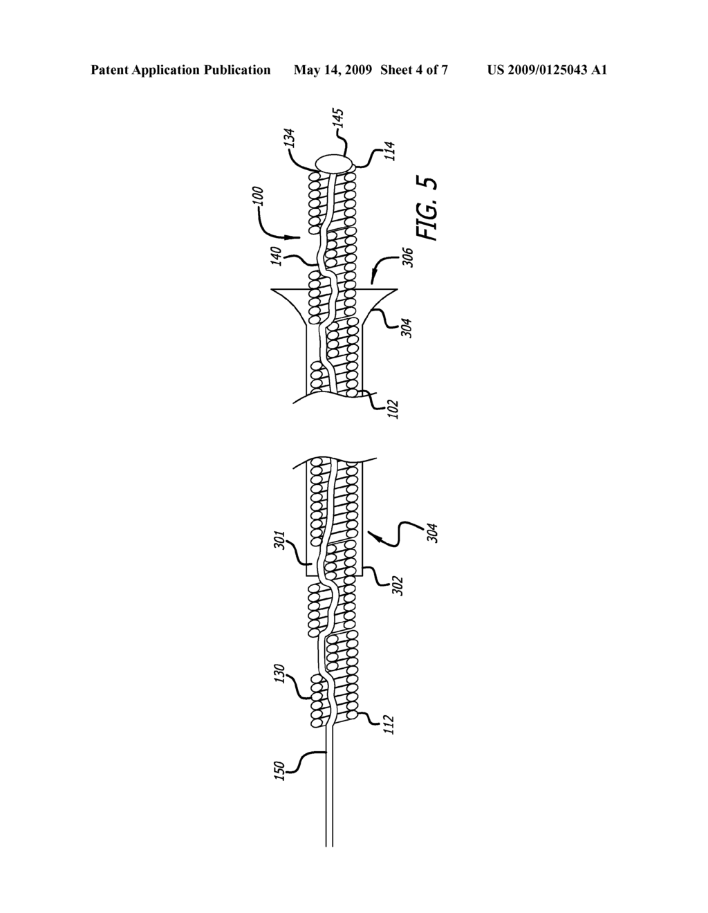 TETHERED COIL FOR TREATMENT OF BODY LUMENS - diagram, schematic, and image 05