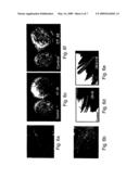 Polynucleotides and polypeptides involved in plant fiber development and methods of using same diagram and image