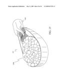 Packaging Cap diagram and image