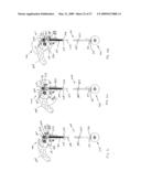 BRAKE ASSEMBLY AND CONTROL MECHANISM FOR A CART, AND METHOD diagram and image