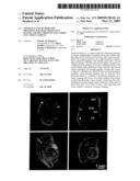 Apparatus and method for obtaining magnetic resonance imaging or spectroscopy data from live tissue samples diagram and image