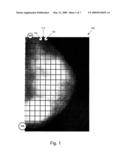 METHOD AND SYSTEM OF PROVIDING A PROBABILITY DISTRIBUTION TO AID THE DETECTION OF TUMORS IN MAMMOGRAM IMAGES diagram and image