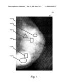 VOTING IN MAMMOGRAPHY PROCESSING diagram and image