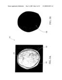 METHOD AND APPARATUS FOR IMAGE SEGMENTATION diagram and image