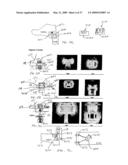 SIDE OPENING UNIFIED POD diagram and image