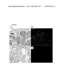 DECELLULARISATION OF TISSUE MATRICES FOR BLADDER IMPLANTATION diagram and image