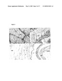 DECELLULARISATION OF TISSUE MATRICES FOR BLADDER IMPLANTATION diagram and image