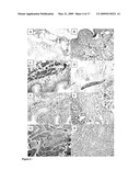 DECELLULARISATION OF TISSUE MATRICES FOR BLADDER IMPLANTATION diagram and image