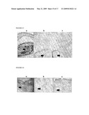 DECELLULARISATION OF TISSUE MATRICES FOR BLADDER IMPLANTATION diagram and image