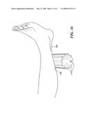 Therapeutic, fitness, and sports enhancement device diagram and image