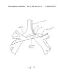 METHOD AND SYSTEM FOR MEASURING PULMONARY ARTERY CIRCULATION INFORMATION diagram and image