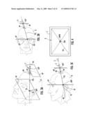 METHODS, SYSTEMS AND COMPUTER PROGRAM PRODUCTS FOR POSITIONING A GUIDANCE APPARATUS RELATIVE TO A PATIENT diagram and image