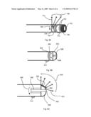 METHOD AND APPARATUS FOR INTRAVASCULAR IMAGING AND OCCLUSION CROSSING diagram and image