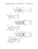 GUIDE SYSTEM AND ASSOCIATED METHOD FOR INSTALLING AN IMPLANT DEVICE ADAPTED TO APPLY COMPRESSION ACROSS A FRACTURE SITE diagram and image