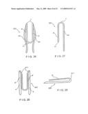 GUIDE SYSTEM AND ASSOCIATED METHOD FOR INSTALLING AN IMPLANT DEVICE ADAPTED TO APPLY COMPRESSION ACROSS A FRACTURE SITE diagram and image