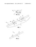 Mobile spine stabilization device diagram and image