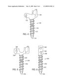 BONE ANCHOR AND SPINAL ALIGNMENT SYSTEM diagram and image