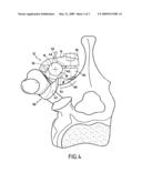 VERTEBRAL FIXING SYSTEM diagram and image