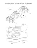 Cervical plate with a feedback device for selective association with bone screw blocking mechanism diagram and image