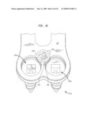 Cervical plate with a feedback device for selective association with bone screw blocking mechanism diagram and image