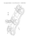 Cervical plate with a feedback device for selective association with bone screw blocking mechanism diagram and image