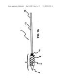 SYSTEM AND METHOD FOR THE FIXATION OF BONE FRACTURES diagram and image