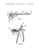 SYSTEM AND METHOD FOR THE FIXATION OF BONE FRACTURES diagram and image