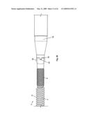 EXPANDABLE ATTACHMENT DEVICE AND METHOD diagram and image