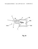 EXPANDABLE ATTACHMENT DEVICE AND METHOD diagram and image