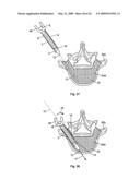 EXPANDABLE ATTACHMENT DEVICE AND METHOD diagram and image