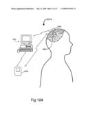 MICRODEVICE-BASED ELECTRODE ASSEMBLIES AND ASSOCIATED NEURAL STIMULATION SYSTEMS, DEVICES, AND METHODS diagram and image