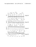 Tachycardia hemodynamics detection based on cardiac mechanical sensor signal regularity diagram and image