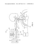 BAROREFLEX ACTIVATION THERAPY WITH CONDITIONAL SHUT OFF diagram and image