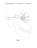 Automatic Fitting for a Visual Prosthesis diagram and image