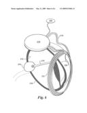 Automatic Fitting for a Visual Prosthesis diagram and image