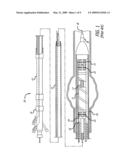 SECUREMENT ASSEMBLY AND METHOD FOR EXPANDABLE ENDOVASCULAR DEVICE diagram and image