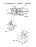 SECUREMENT ASSEMBLY AND METHOD FOR EXPANDABLE ENDOVASCULAR DEVICE diagram and image