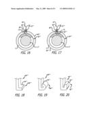 SECUREMENT ASSEMBLY AND METHOD FOR EXPANDABLE ENDOVASCULAR DEVICE diagram and image