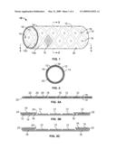 STENTS WITH METALLIC COVERS AND METHODS OF MAKING SAME diagram and image