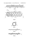 STENTS WITH METALLIC COVERS AND METHODS OF MAKING SAME diagram and image