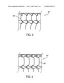 COMPOSITE STENT WITH INNER AND OUTER STENT ELEMENTS AND METHOD OF USING THE SAME diagram and image