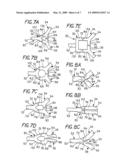 BIFURCATED STENTING APPRATUS AND METHOD diagram and image