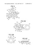 BIFURCATED STENTING APPRATUS AND METHOD diagram and image