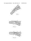 Extendible Stent Apparatus and Method for Deploying the Same diagram and image