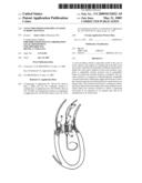 Valve prosthesis for implantation in body channels diagram and image