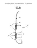 Valve prosthesis for implantation in body channels diagram and image