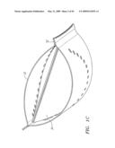 Prosthetic Heart Valves, Support Structures and Systems and Methods for Implanting the Same diagram and image