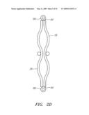 Prosthetic Heart Valves, Support Structures and Systems and Methods for Implanting the Same diagram and image