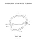 Prosthetic Heart Valves, Support Structures and Systems and Methods for Implanting the Same diagram and image