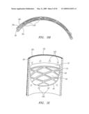 Prosthetic Heart Valves, Support Structures and Systems and Methods for Implanting the Same diagram and image